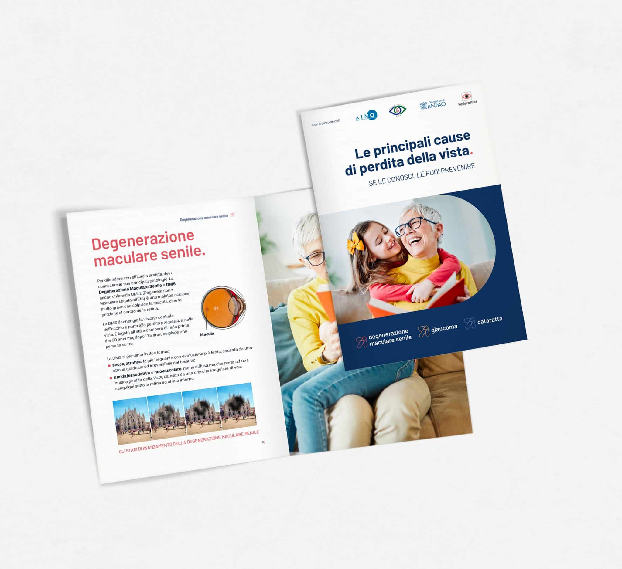 Opuscolo “Le principali cause di perdita della vista”